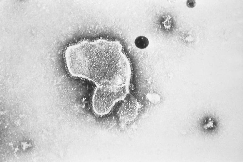 Fotografía del virus respiratorio sincitial mediante micrografía electrónica.
