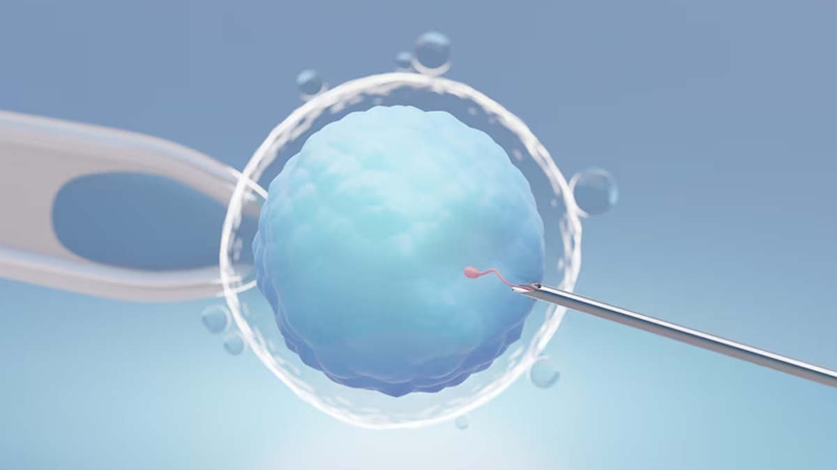 fertilización in vitro