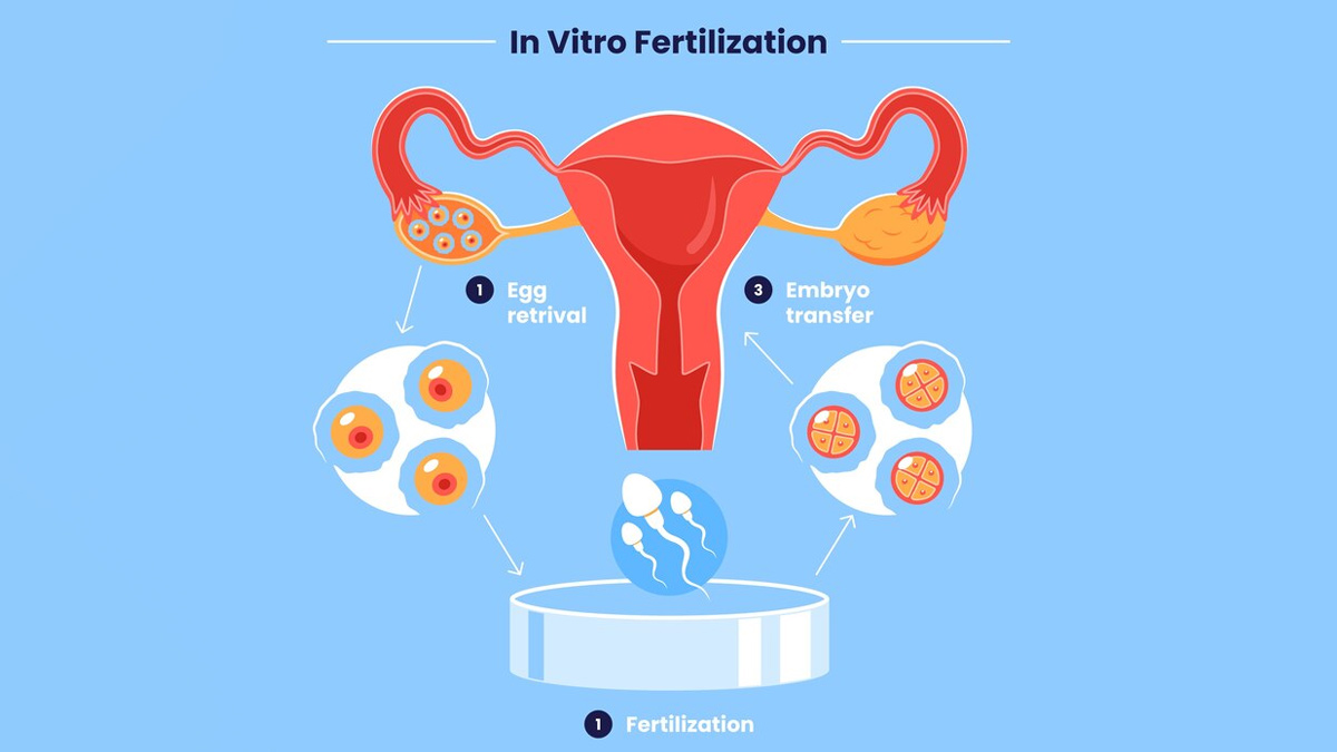 fertilización in vitro