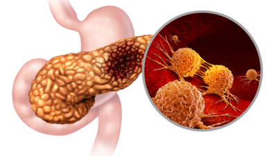 ¿Es la vitamina B12 crucial para la salud pancreática? Por eso el médico dijo que sí