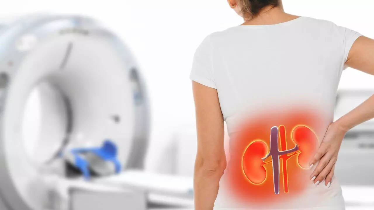 La vitamina C causa cálculos renales